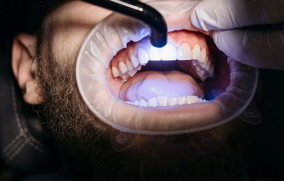 Slider image (7) Perio & Implants Tijuana